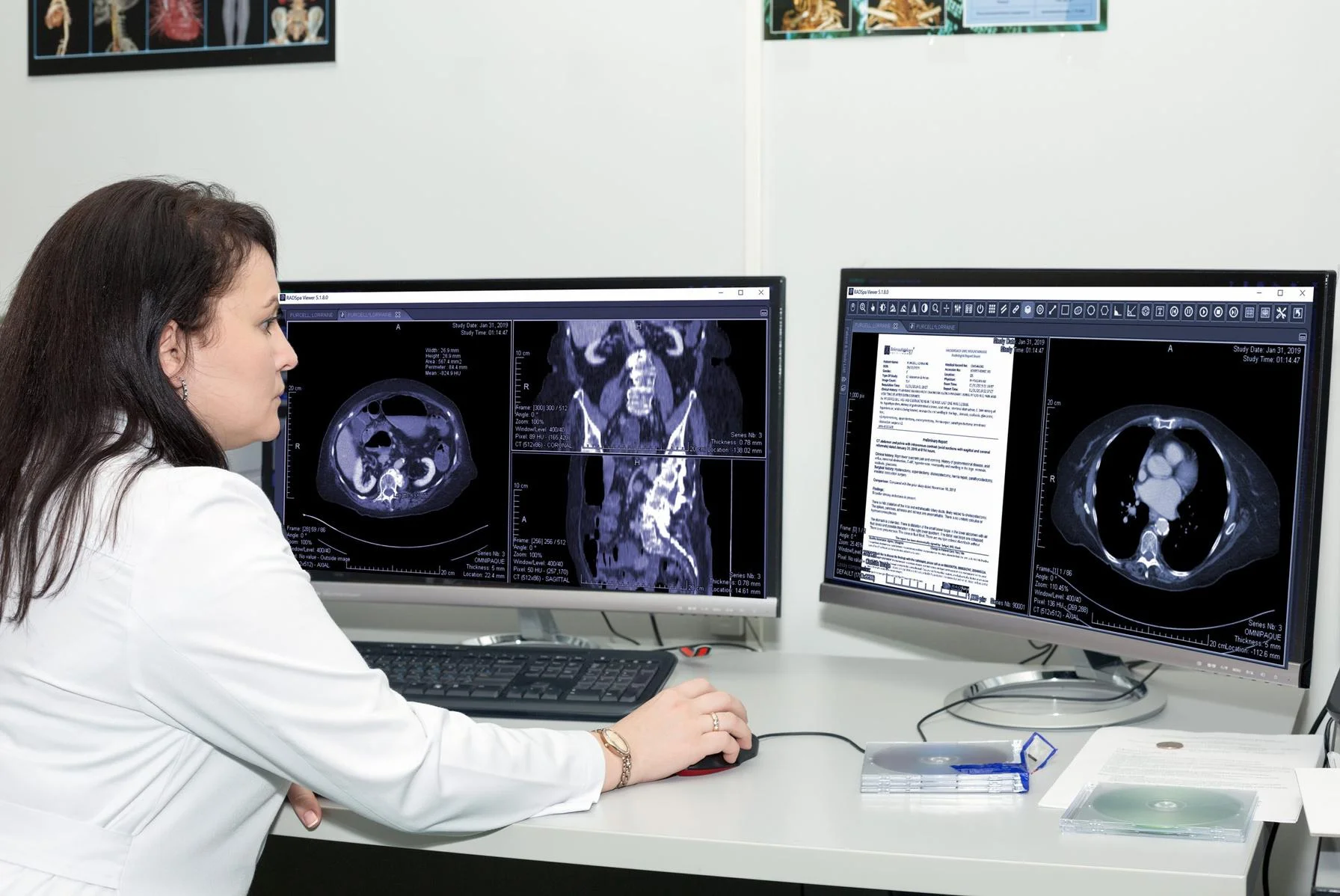 Enhancing Diagnostic Imaging with sepStream: Advanced, Affordable Enterprise PACS Solutions